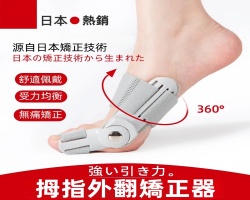 拇指外翻矯形器